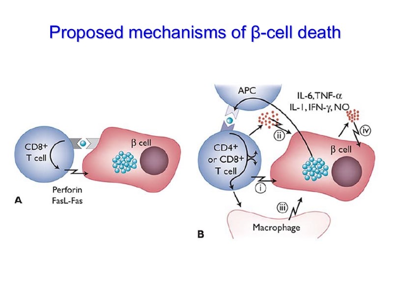 Proposed mechanisms of β-cell death